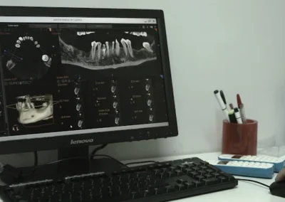 galeria navas dental 14